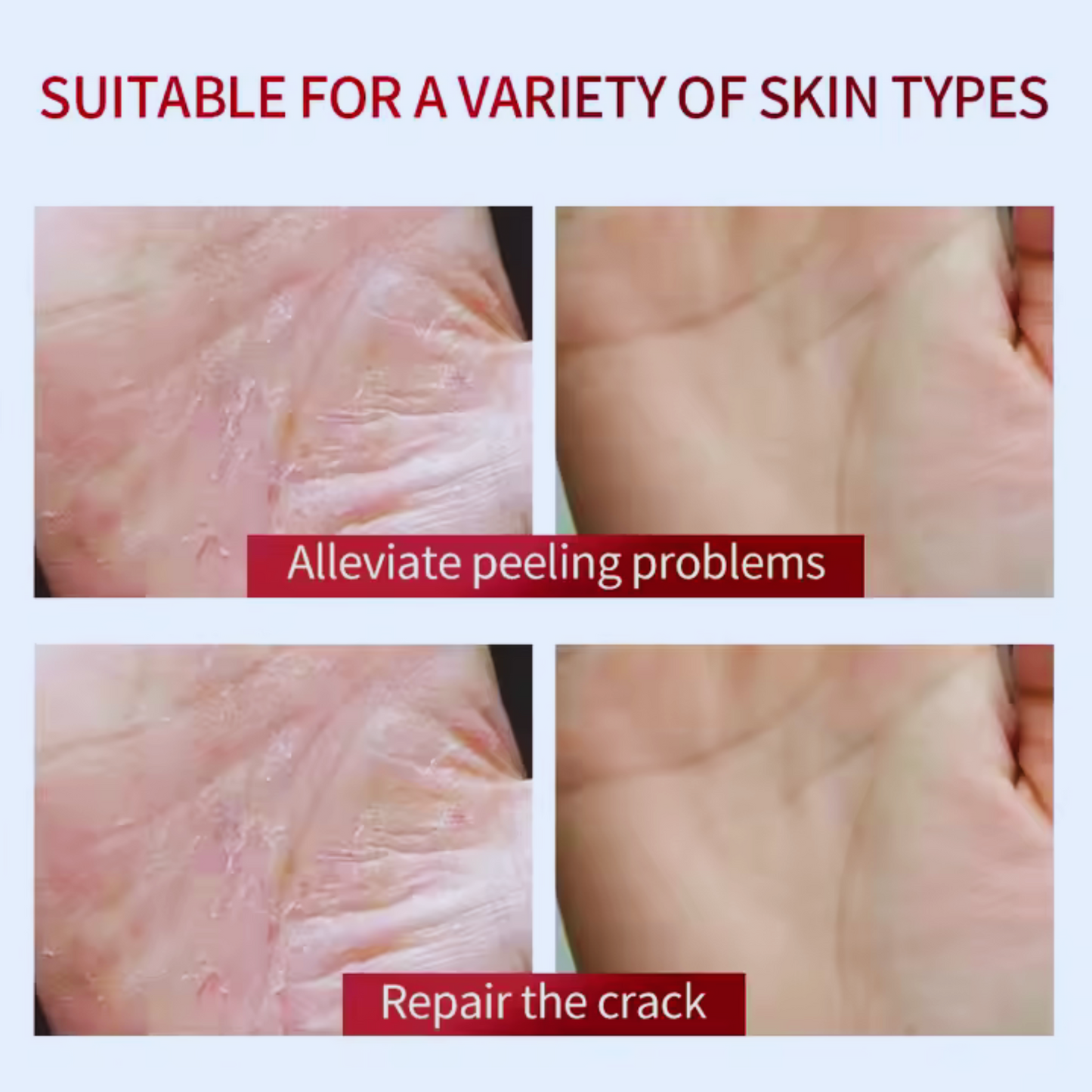 Luxury Foot Care Cream Skin Revitalizer Exfoliating Organic Horse Oil Hand and Foot Cream Lightening Creams - DermaFix Solutions